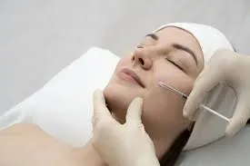 PDRN Treatment image 1
