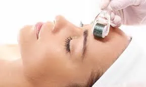Derma Roller Treatment image 1