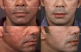 Skin Rejuvenating Treatment image 1
