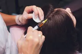 Advance Hair Treatments image 1