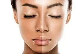 Fairness Treatments image 1