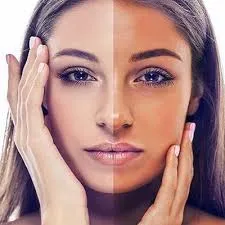 Tan Removal Treatment  image 1