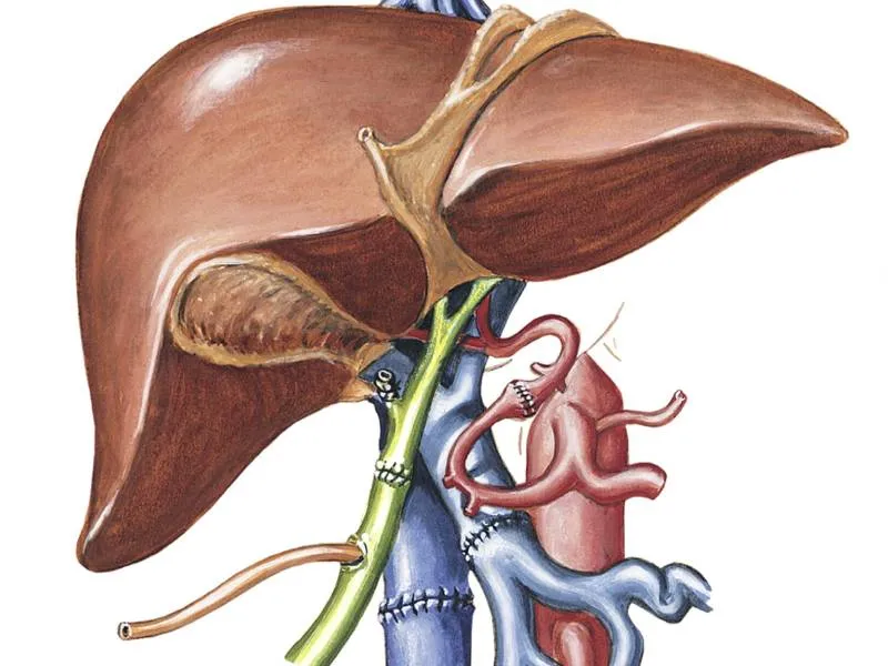 Best Liver Transplant Doctor Near Me image 1