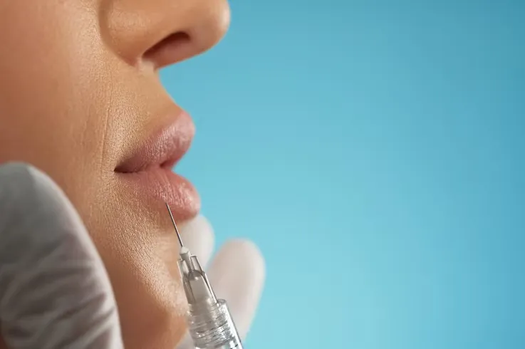 Lip Lightening Treatment image 1