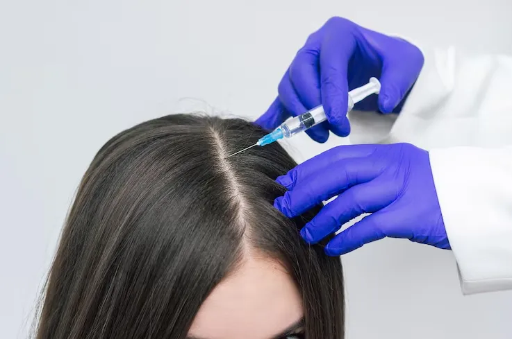 Hair PRP Therapy image 1