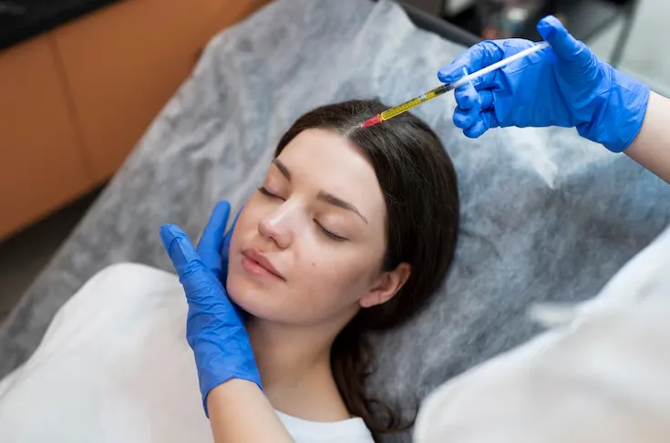 Microneedling with PRP image 1