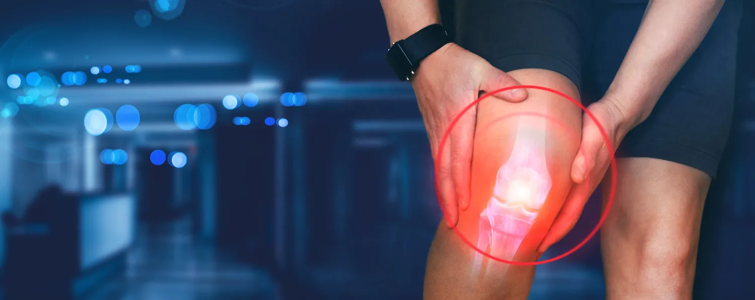OSTEOARTHRITIS image 1