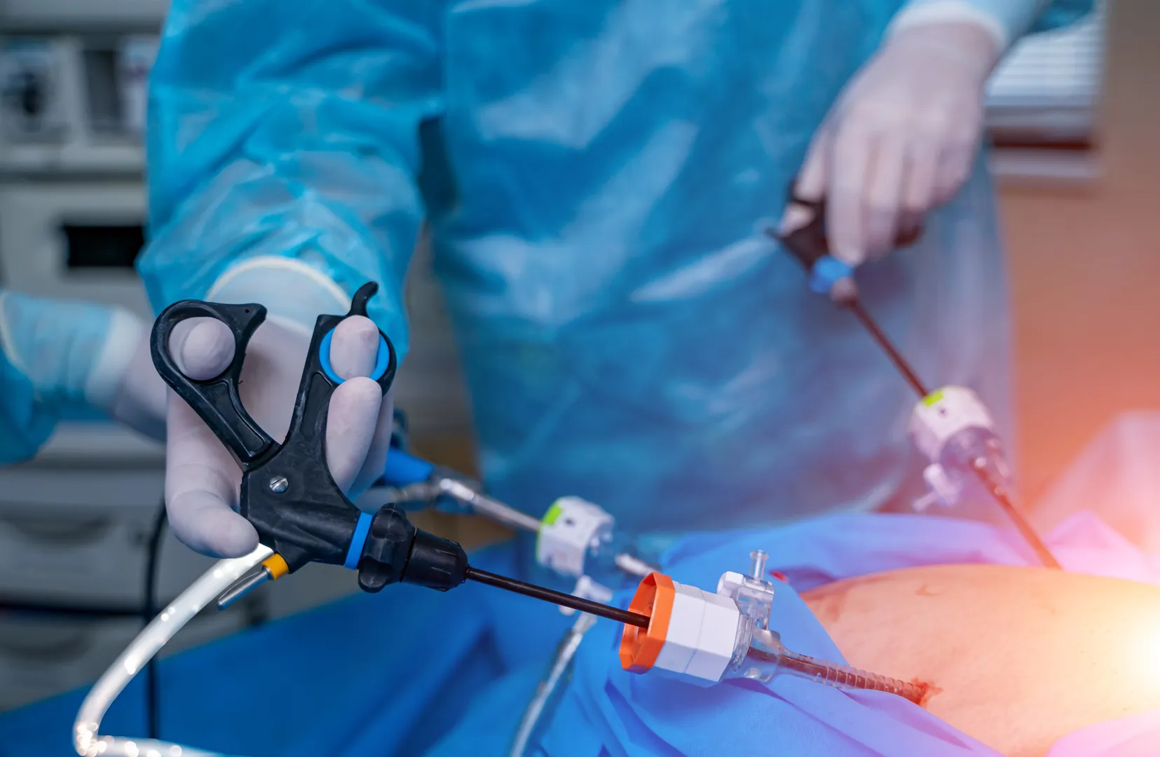 Laparoscopic Cancer Surgeries image 1