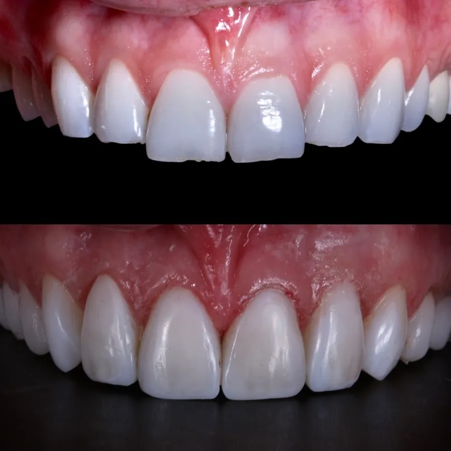 Cosmetic Dentistry-Smile Designing image 1