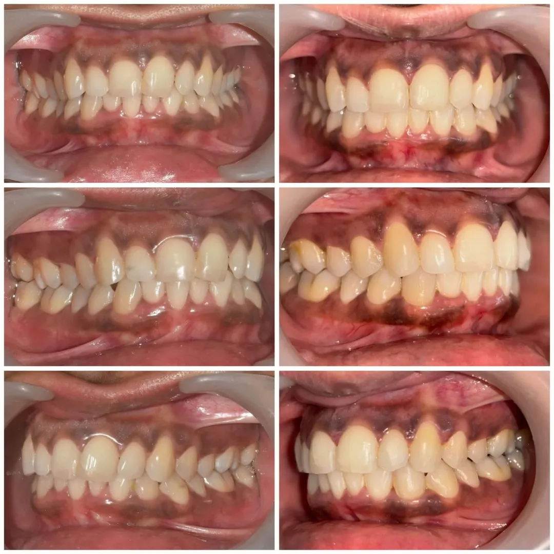 Orthodontic Treatment image 1
