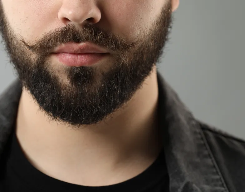 Moustache Transplantation image 1