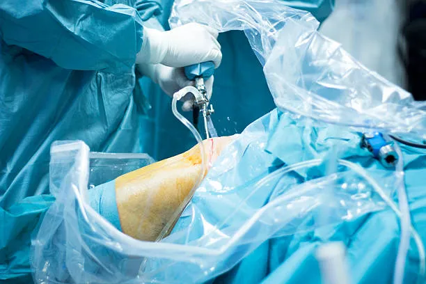 MINIMALLY INVASIVE JOINT SURGERIES/ARTHROSCOPY image 1