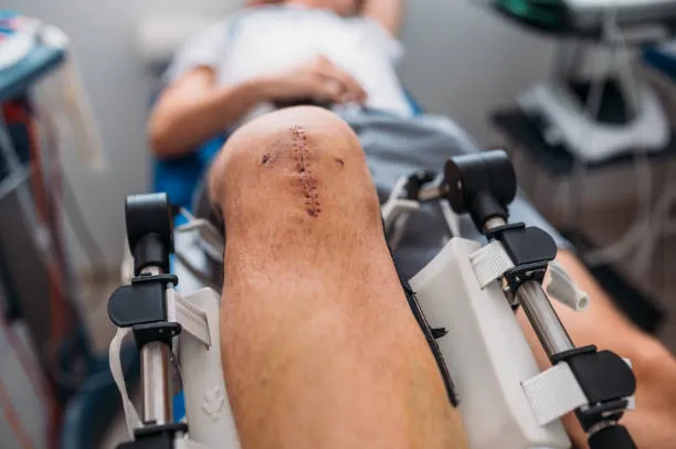Knee Surgery image 1
