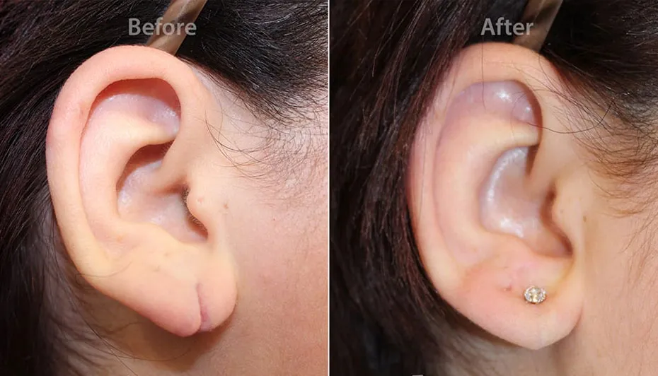 Dermatosurgery image 1