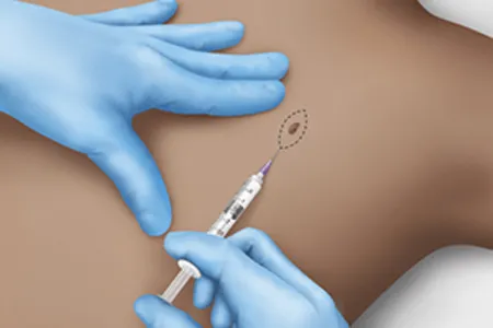 Dermatosurgery image 1