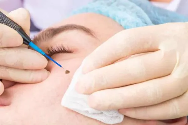Dermatosurgery image 1