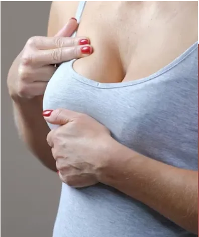 Breast Augmentation image 1