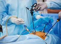 GENERAL & LAPROSCOPIC SURGERIES image 1
