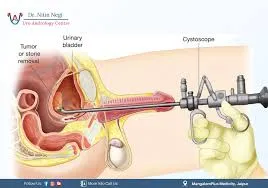 UROLOGY SURGERY image 1