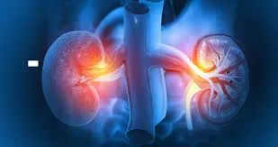 Nephrology image 1