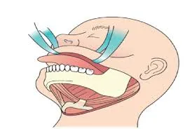 ONCOSURGERY  image 1