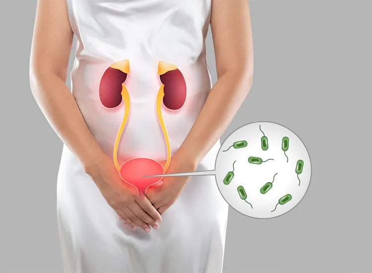 Urinary tract infection  image 1