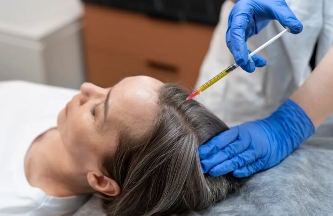 PRP & GFC Therapy for Hair Growth in Bibwewadi, Kondhwa, Swargate, Pune, PCMC  image 1