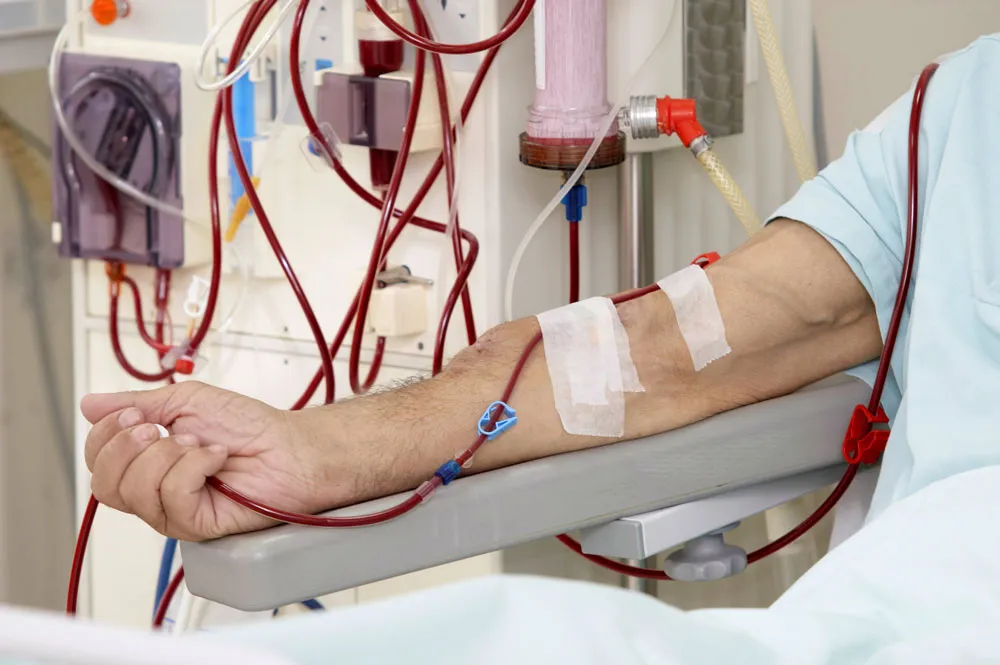 Dialysis treatment in Moshi  image 1