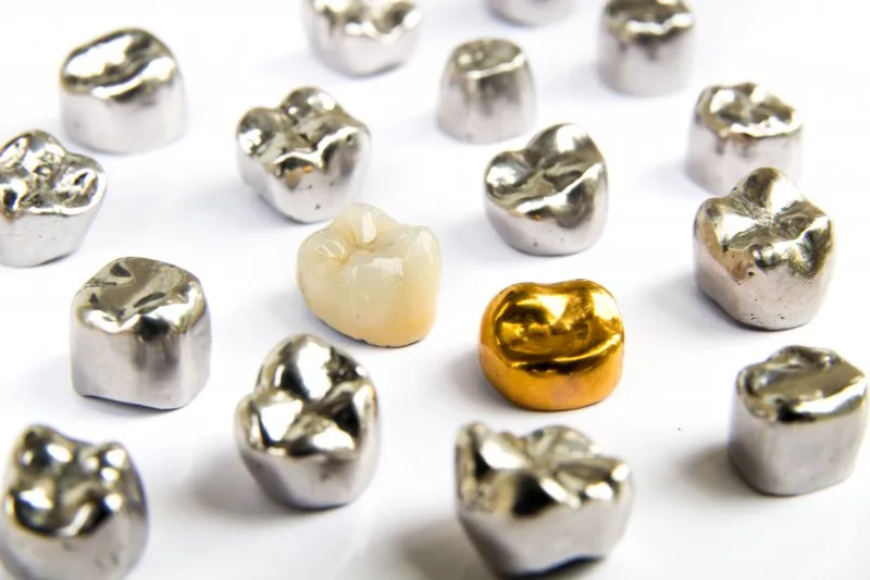 Metal Crown Cap treatment in Kharadi , Wadgaon Sheri image 1
