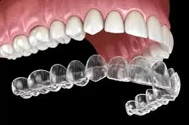 Invisalign image 1