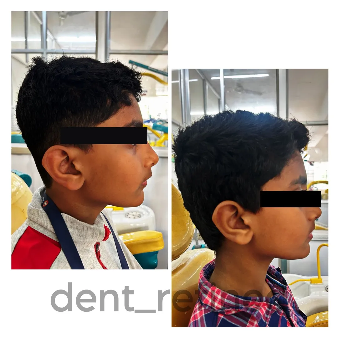 Pediatric Dentist in Coimbatore image 1