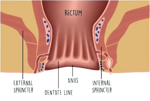 Piles,Fissure,Fistula Surgeon in Thane image 1