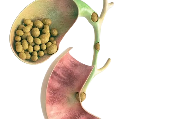 Gallbladder/Gallstone Surgeon in Pune image 1