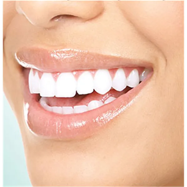 Teeth whitening image 1