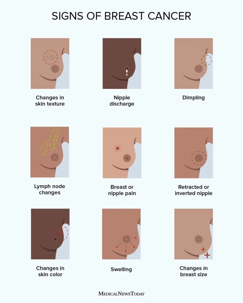 Breast Cancer image 1