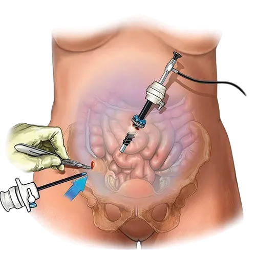 Laparoscopic Cancer Surgeon in Mahim,Mumbai image 1
