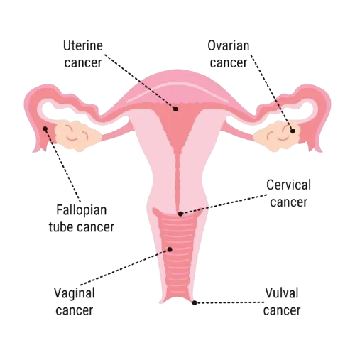 Gynecological Cancer Surgeon in Mahim,Mumbai image 1
