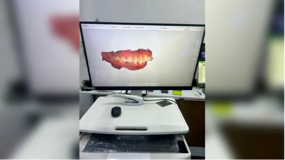 3D Intraoral Digital Scan image 1