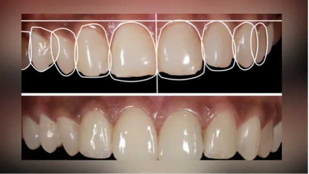 Smile Designing image 1