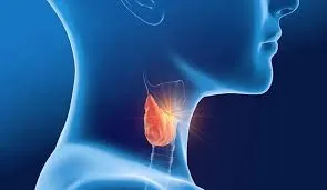 Thyroid Gland Surgery image 1
