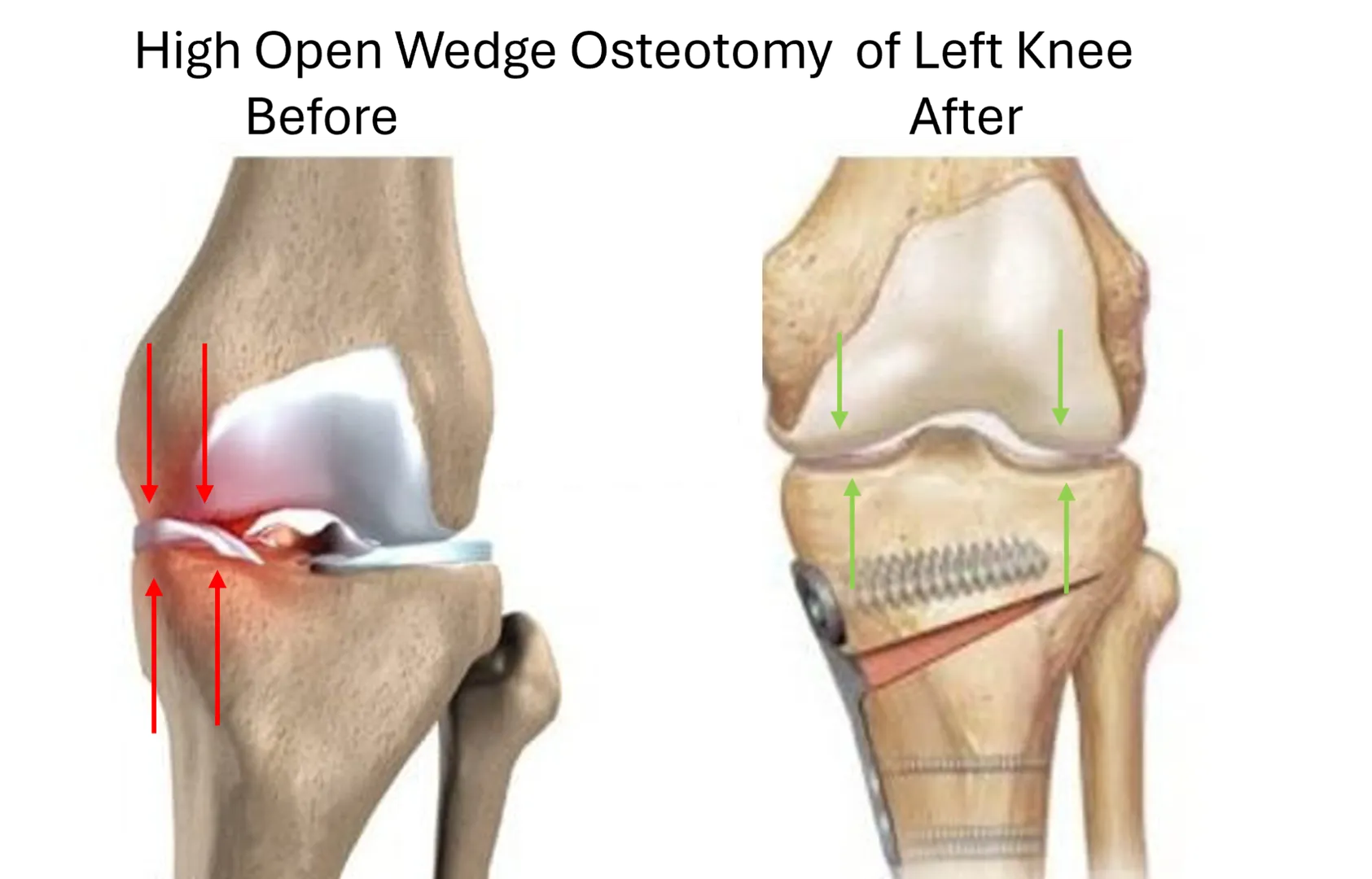 Osteotomy In Dadar image 1