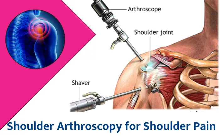 Soft Tissue Repair And Tendon Repairs In Dadar image 1