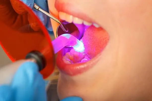 Cosmetic filling image 1