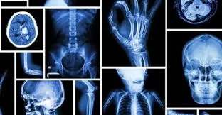Radiology image 1
