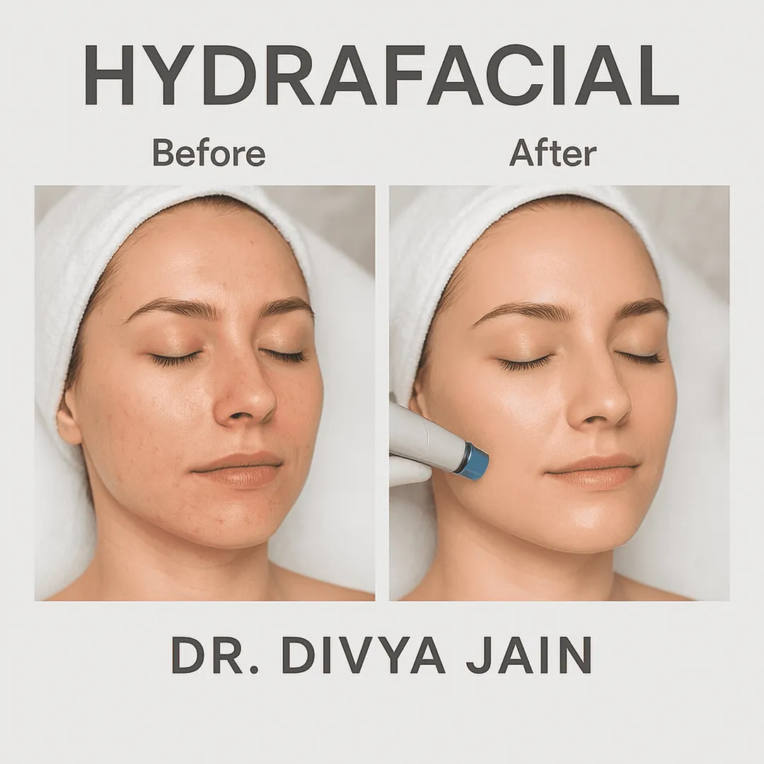 Hydra Facial image 1