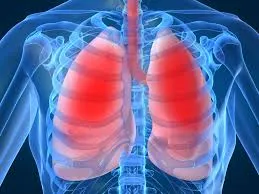 Pulmonology image 1