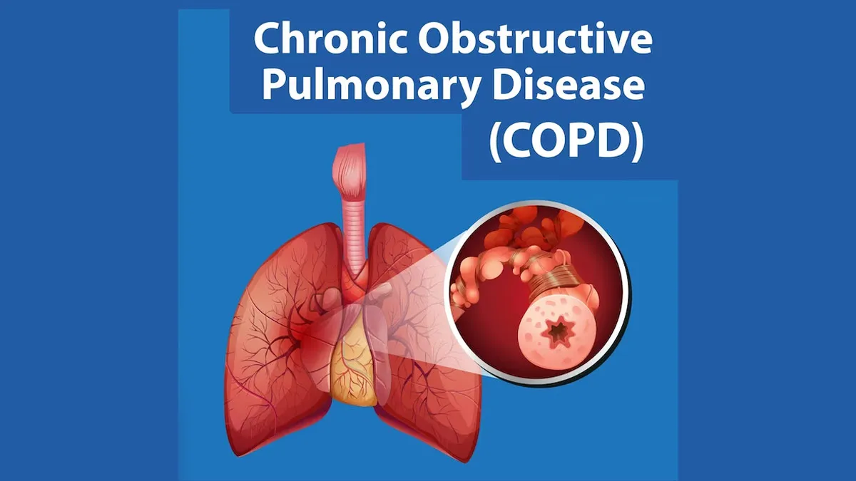 Chronic Obstructive Pulmonary Disease (COPD) Treatment image 1