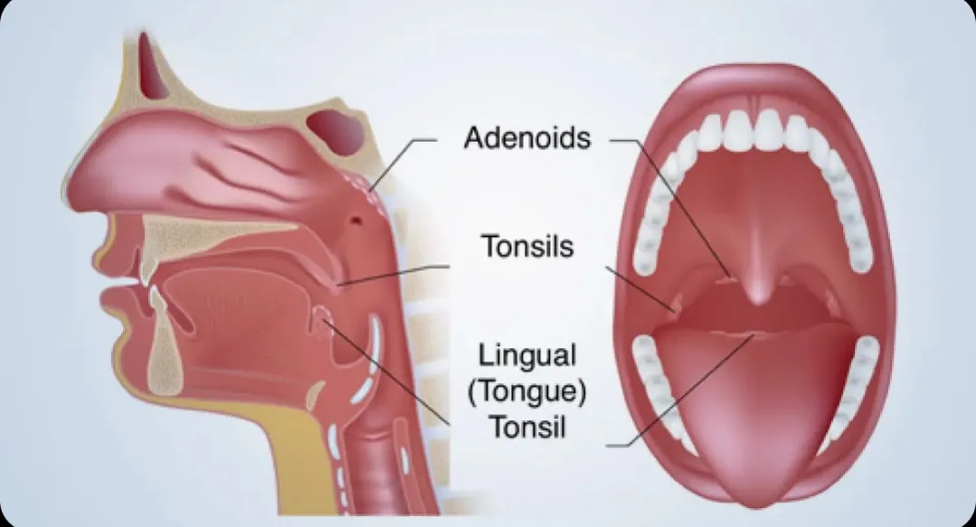 Best Tonsil and Adenoid Surgeon in Bavdhan, Kothrud, Pune, PCMC  image 1