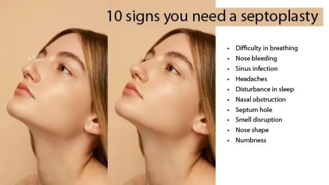 Best Septoplasty Surgeon in Bavdhan, Kothrud,Pune and PCMC  image 1
