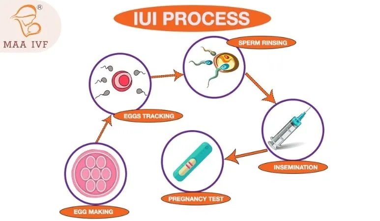 INTRA UTERINE INSEMINATION (IUI) image 3